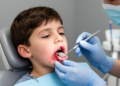 Chemical Mouth Injury and Bacterial Infection Triggered Erythema Multiforme in an 11-Year-Old Boy