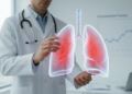 Hypersensitivity Pneumonitis Deaths Rose Steadily Across 32 Countries Over Two Decades