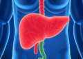 Blocking Fructose Metabolism Improves Insulin Sensitivity in Fatty Liver Disease Trial