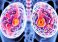 Tumor Stiffness Fingerprinted: Rheology and 3D Spheroids Map Breast Cancer Mechanics