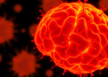 Mini-GRID Radiotherapy Curbs Cellular Senescence While Keeping Its Anti-Tumor Punch in Glioma Cells