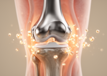 Low-Dose Clindamycin Achieves 82% Two-Year Success Against Prosthetic Joint Infections