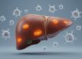 Liver Injury Affects One in Eight Patients on Immune Checkpoint Inhibitors in Real-World Study