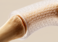 Printed Bone Sleeve Cuts Strain in Fragile Scaffolds for Large Defects