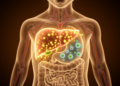 Gut Microbe Bile Acid Isoallo-LCA Eases Acute Liver Transplant Rejection in Mice via NR4A1/FOXP3 Pathway