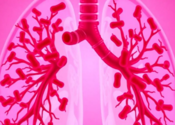 Neutrophil Traps in the Blood Show Strong Promise for Diagnosing Pneumonia and Spotting Mixed Infections