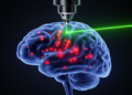3D Confocal Imaging Exposes Hidden Bias in Cerebral Microhemorrhage Counts