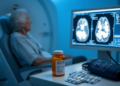 Warfarin Exposure, Not Standard Monitoring, Tracks Brain Small Vessel Damage in Elderly Stroke Patients