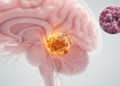 Rare Brain Tumor Puzzle: Fetal-Type Cancer in the Cerebellopontine Angle With No Lung Primary Found