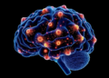 AI Maps the Hidden Diversity of Amyloid Plaques Across the Alzheimer's Brain