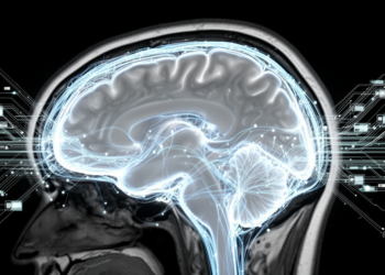 Attention-Guided Distillation Boost Alzheimer's Stage Identification Using MRI Scans