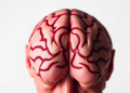 Myasthenia Gravis Strikes Hardest After 65, But Long-Term Outlook May Surprise