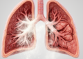 Massive Gluten-Free Flour Inhalation Leads to Severe Bronchial Obstruction and Lung Atelectasis
