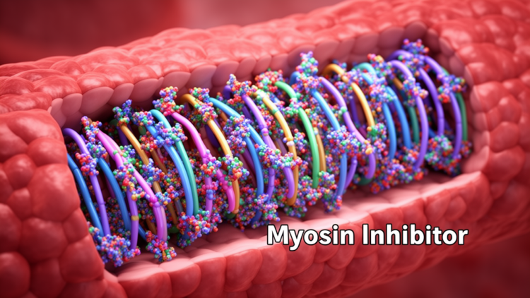 New myosin inhibitors reshape treatment of obstructive hypertrophic cardiomyopathy