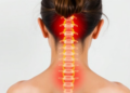 Acupuncture Eases Axial Spondyloarthritis Pain, But Benefits Fade by One Year