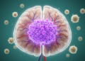 Cancer Stem Cells, Immune Evasion and Vascularization Drive Therapy Resistance in Brain Tumors