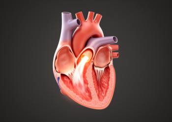 Atrial form of secondary mitral regurgitation dominates in the general population