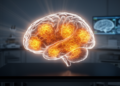 Tau PET Imaging Shows Faster Tau Buildup Tracks Faster Decline in PSP