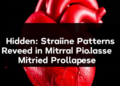 Hidden Heart Strain Patterns Revealed in Mitral Valve Prolapse