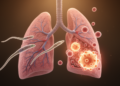 Single-Sex Schistosome Infections Rewire Lung Memory T Cells on Rechallenge