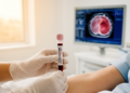 Blood test tracks sarcoma progression closely alongside imaging in real-world cohort