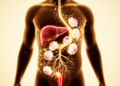 Paeony Root Extract May Disrupt Cirrhosis's Gut–Liver Vicious Cycle, Review Proposes