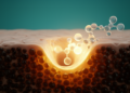SMYD3 Emerges as a Potential Therapeutic Target in Uveal Melanoma