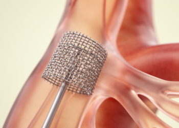 Fifteen Years of Subclavian Artery Occlusion Devices Have Not Yet Proven Better Outcomes
