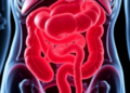 AI and Multi-Omics Could Predict Necrotizing Enterocolitis Before Symptoms Strike