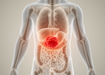 Tumour location shapes survival in rare leiomyosarcoma, study of 11,700 patients finds