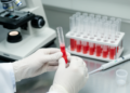 Negative Coombs Test Does Not Exclude Immune Anemia