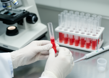 Negative Coombs Test Does Not Exclude Immune Anemia