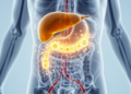 Immunotherapy plus chemotherapy shows durable responses in lymph-node-dominant metastatic gallbladder cancer