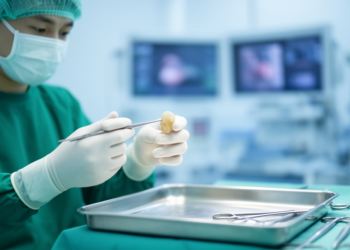 Kidney transplant stone treatment outcomes rest on shaky evidence, review finds