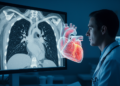 Early CT-Derived Heart Tissue Measure Flags Death Risk in Aortic Dissection