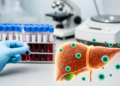 Serum Asprosin Tracks Sex, Not Fibrosis, in Chronic Hepatitis C