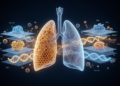 Genes, Environment and Multi-Omics Maps Reshape How IPF Is Understood and Predicted