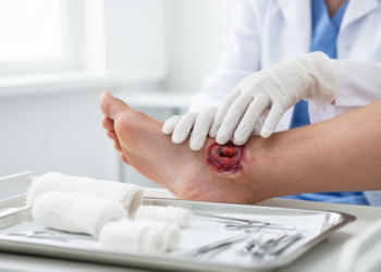 Liraglutide speeds diabetic foot ulcer healing in randomized trial