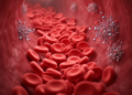 Danicopan added to ravulizumab eased anemia in a PNH case report