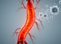 Takayasu Arteritis May Rarely Cluster With Other Autoimmune Diseases, Review Finds