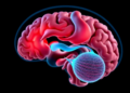 When an Ear Infection Reaches the Brain: A Case of Sinus Thrombosis, Abscess and Hydrocephalus