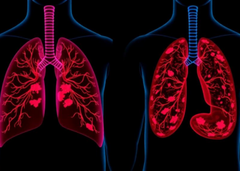 AI Blends Deep and Handcrafted Features to Spot Lung and Colon Cancer with 99.4% Accuracy
