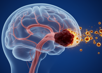 Traumatic Venous Sinus Thrombosis: Anticoagulation Benefit Remains Uncertain in 14-Year Study