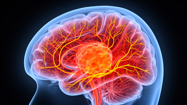 MRI Blood-Flow Technique Tracks Tumour Vessel Density Without Contrast Agents