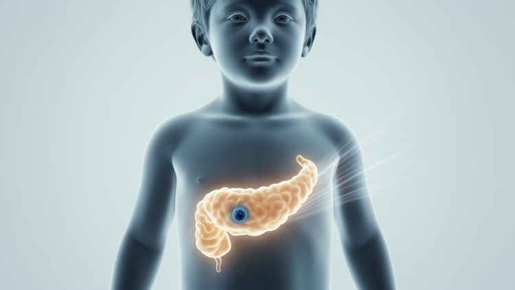 Paediatric insulinomas often appear dark on FDOPA PET scans, not bright