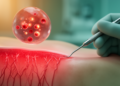 Blood biomarkers track gum disease and gingival microcirculation in type 2 diabetes