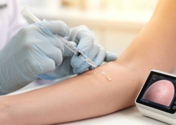 Liquid Polycaprolactone Injections Show Skin Firmness Signals in Small Uncontrolled Trial