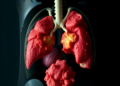 Scurvy Returns: A Modern Diagnostic Puzzle After Weight-Loss Surgery