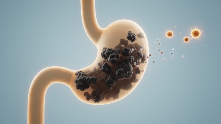 Cholangiocarcinoma: New Advances Expose Stubborn Gaps in a Deadly Bile Duct Cancer