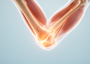 Floating elbow injuries in children fare no worse than isolated humeral fractures in surgical study